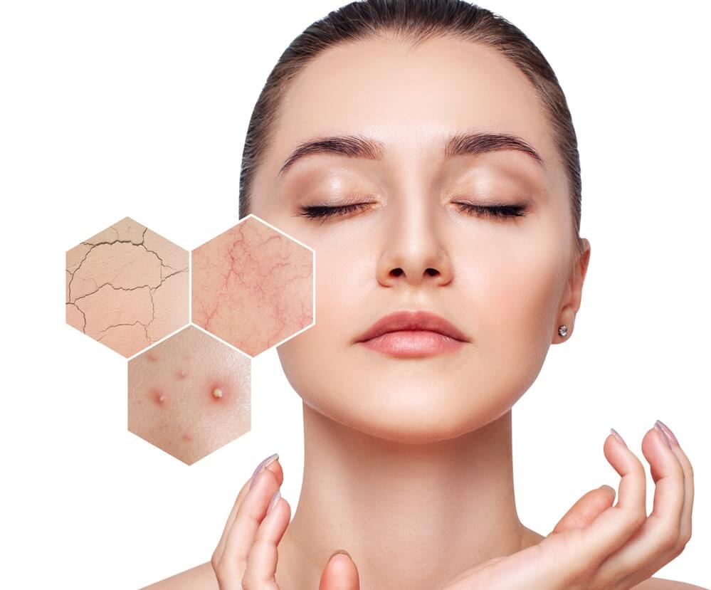 تغذیه و سبک زندگی موثر بر سلامت پوست خشک و حساس