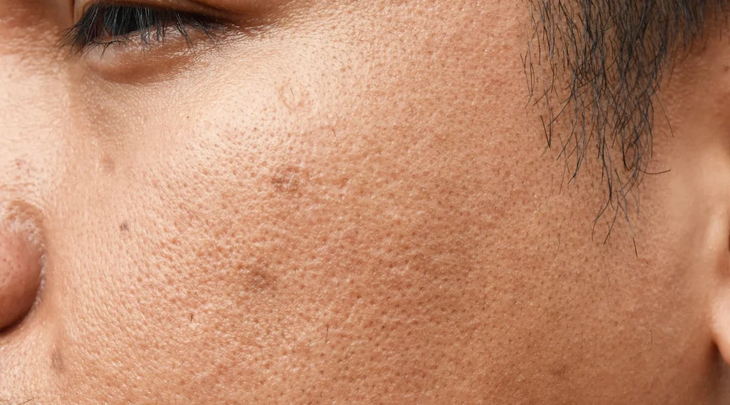 پوست مختلط: ویژگی‌ها و روش‌های مراقبت