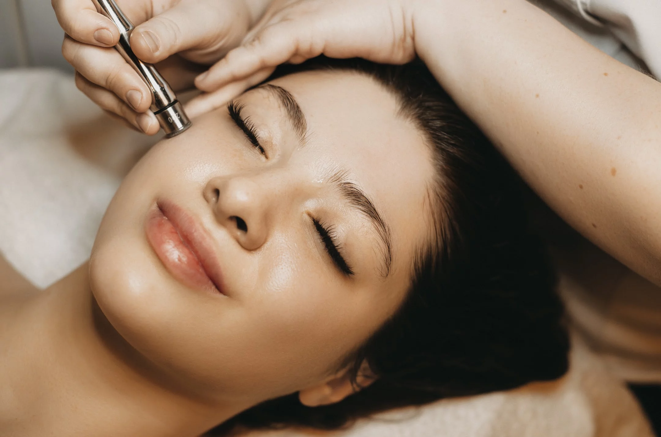 مهم‌ترین مزایای RF Microneedling برای جوانسازی پوست